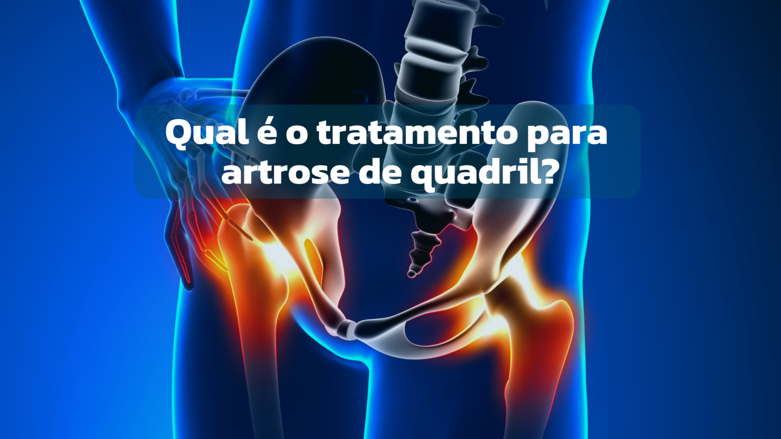 Qual é O Tratamento Para Artrose De Quadril Dr Márcio Pozzi